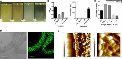 Multicellular String-Like Structure Formation by Salmonella Typhimurium Depends on Cellulose Production: Roles of Diguanylate Cyclases, YedQ and YfiN